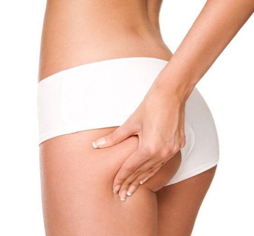 Body Lift (Belt Lipectomy) - Dr. Gideon Maresky Cape Town