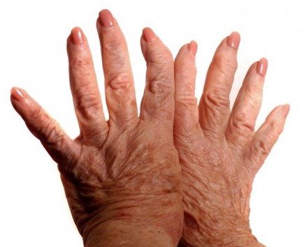 Carpal Tunnel Surgery (Carpal Tunnel Release) thumbnail 2