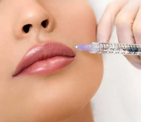 Fat Transfer (Autologous Fat Grafting) - Dr. Gideon Maresky Cape Town