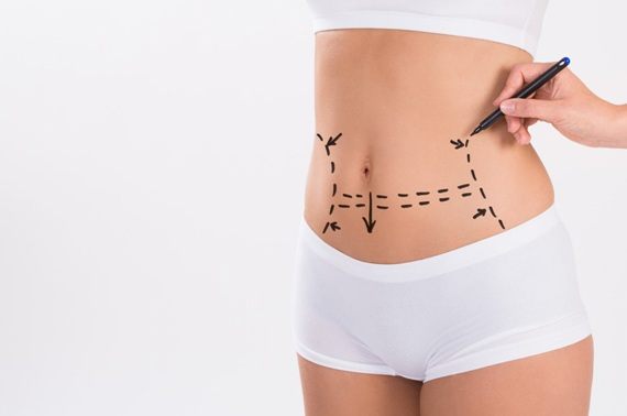 Tummy Tuck (Abdominoplasty, Liposuction) Pre & Post Operative Instructions