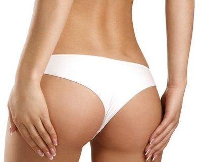 Body Lift (Belt Lipectomy) - Image 4 of 5