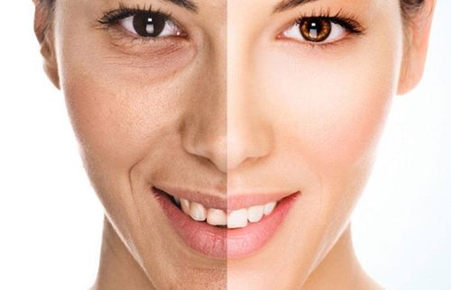 Chemical Peels (Chemexfoliation) - Dr. Gideon Maresky Cape Town