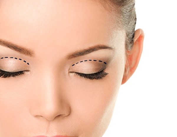 Eyelid Lift (Blepharoplasty) - Dr. Gideon Maresky Cape Town