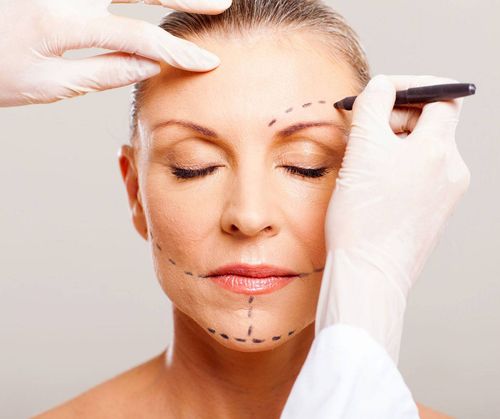 Facelift (Rhytidectomy) - Dr. Gideon Maresky Cape Town