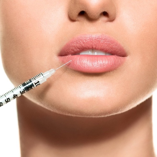 Lip Fillers (Dermal Filler Injections) - Dr. Gideon Maresky Cape Town