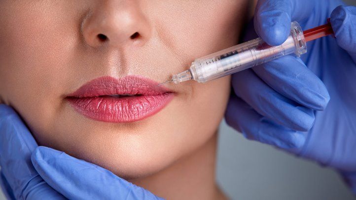 Lip Fillers (Dermal Filler Injections) - Image 3 of 4