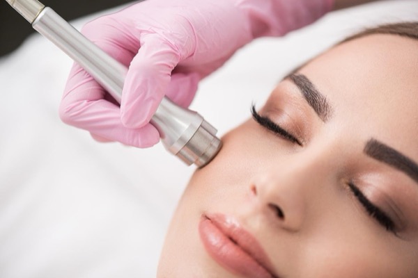 Microdermabrasion (Mechanical Exfoliation) - Dr. Gideon Maresky Cape Town
