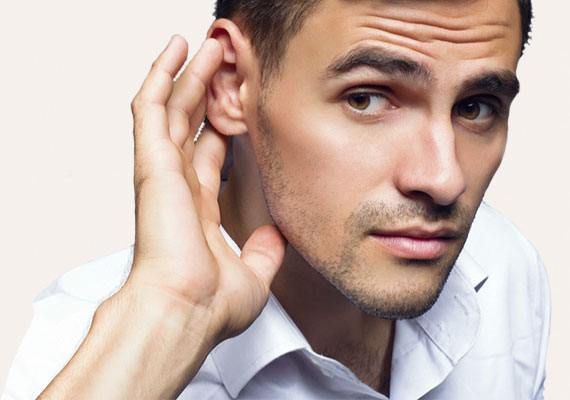 Otoplasty - Image 5 of 6